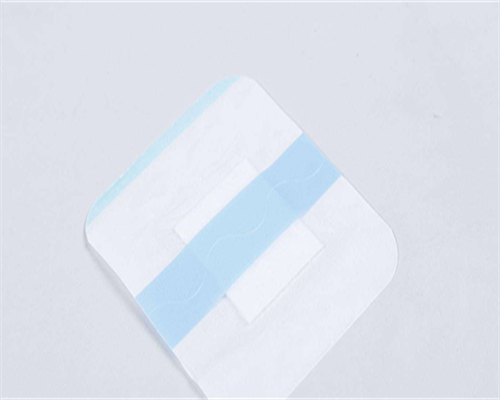 多囊卵巢综合症激素六项检查标准