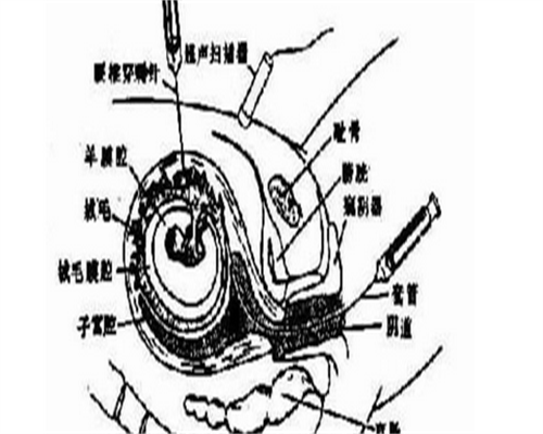 验血测怀孕准确率高吗