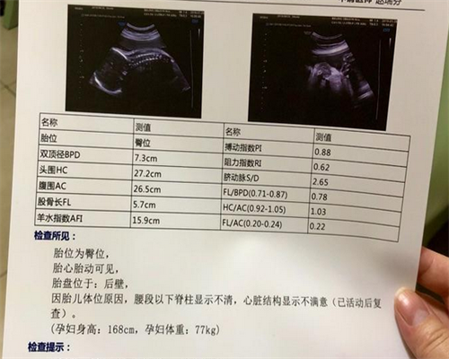 温州怎样做助孕流程