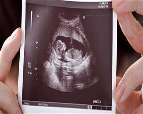 试管婴儿胚胎移植后可以同房吗？